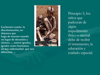 Principio 5, los niños que padezcan de algún impedimento físico o mental debe de recibir el tratamiento, la educación y cuidado especial.  Luchemos contra  la  discriminación, no  dejemos que  haga de nuestro mundo un lugar de desunión y  tristeza … somos iguales, iguales como hermanos  no hay enfermedad  que nos diferencie … 