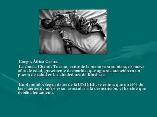 Congo, África Central La abuela Chantis Tuseuo, extiende la mano para su nieta, de nueve años de edad,  gravemente desnutrida,  que aguarda atención en un puesto de salud en los alrededores de Kinshasa.  En el mundo, según datos de la UNICEF, se estima que un 55% de las muertes de niños están asociadas a la desnutrición, el hambre que debilita lentamente.  