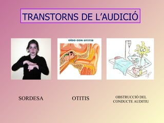 TRANSTORNS DE L’AUDICIÓ




                    OBSTRUCCIÓ DEL
SORDESA   OTITIS   CONDUCTE AUDITIU
 