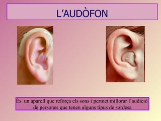 L’AUDÒFON




És un aparell que reforça els sons i permet millorar l’audició
       de persones que tenen alguns tipus de sordesa
 