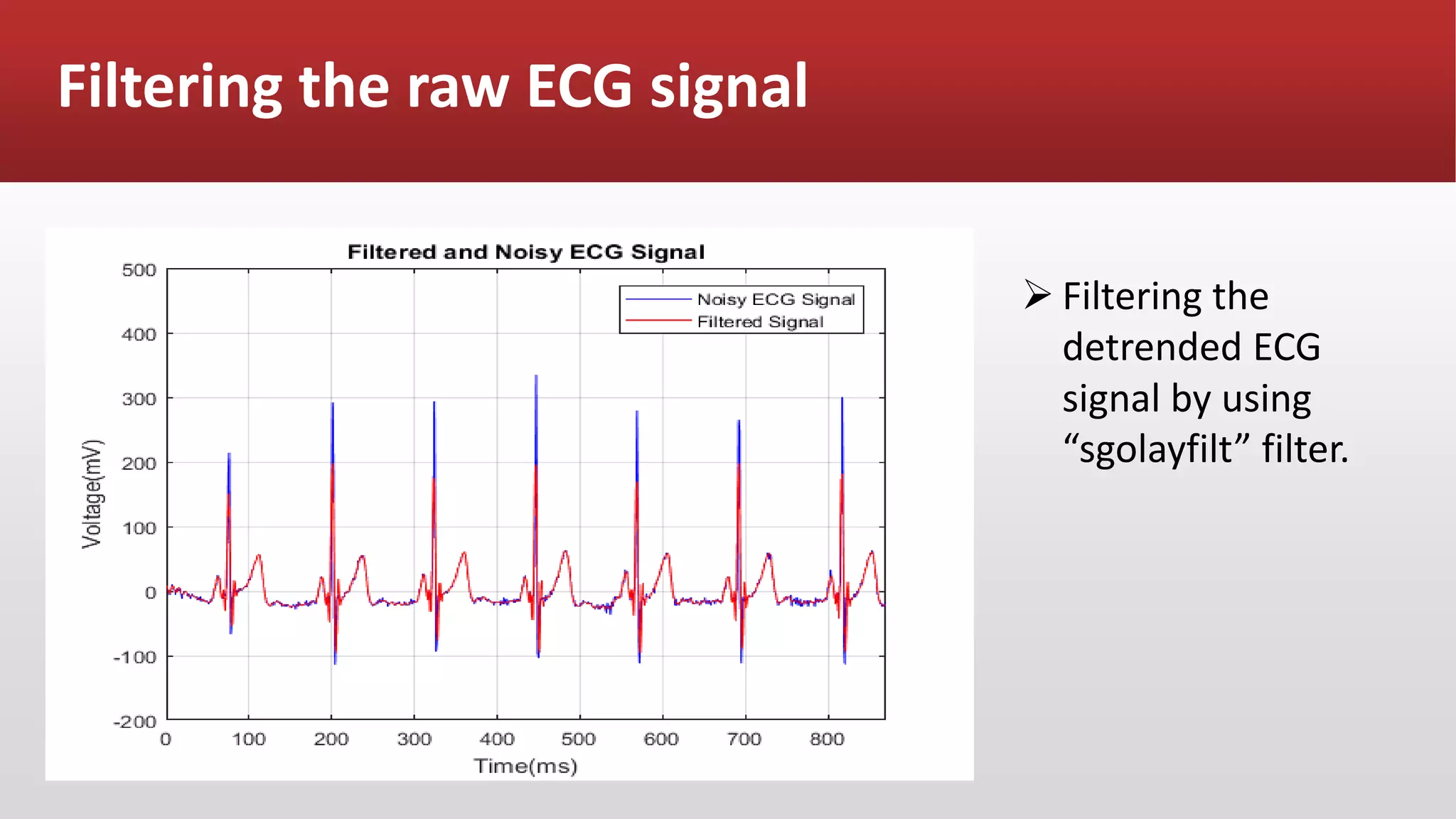Filtering the raw ECG signal
 Filtering the
detrended ECG
signal by using
“sgolayfilt” filter.
 