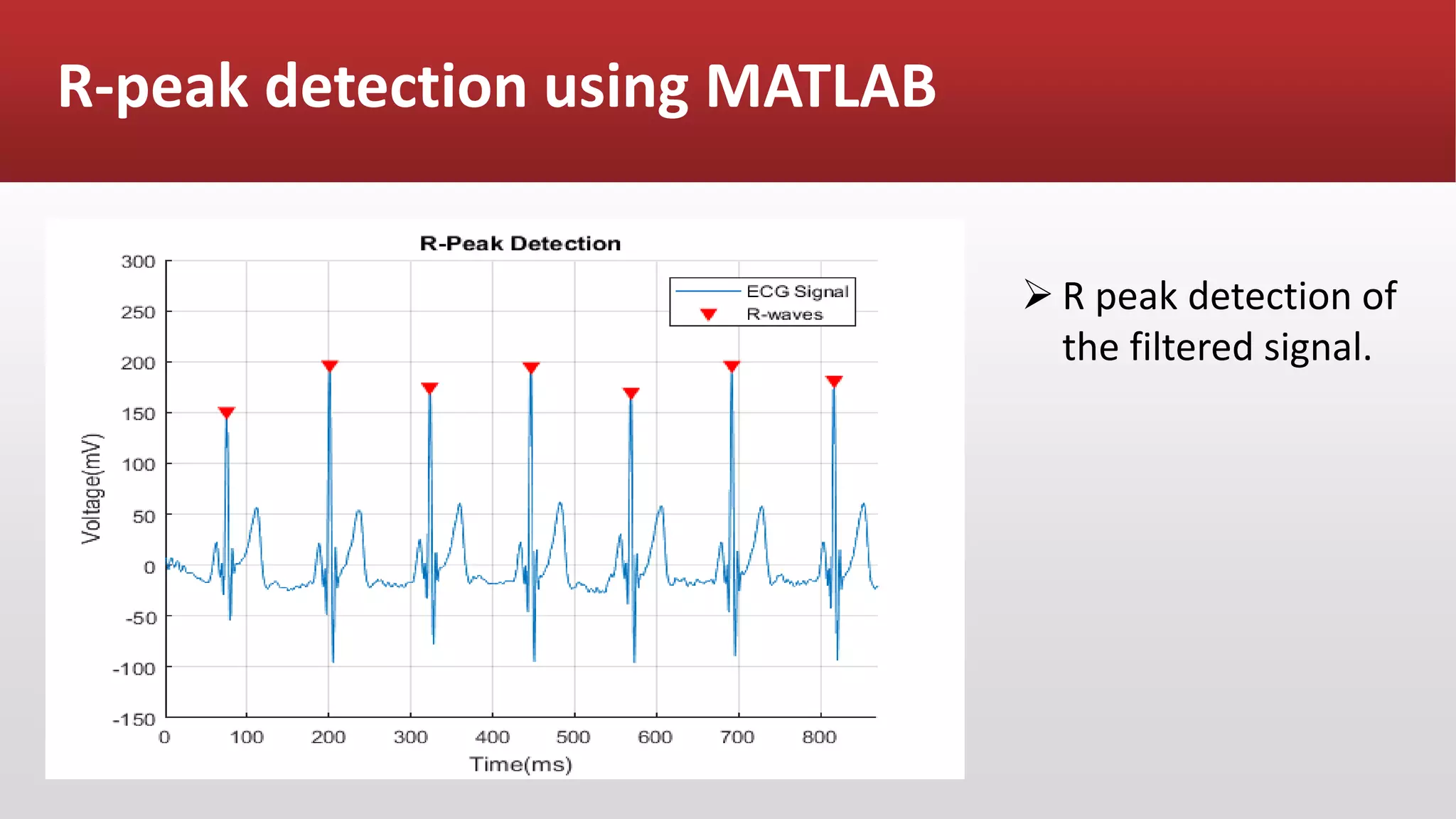 R-peak detection using MATLAB
 R peak detection of
the filtered signal.
 