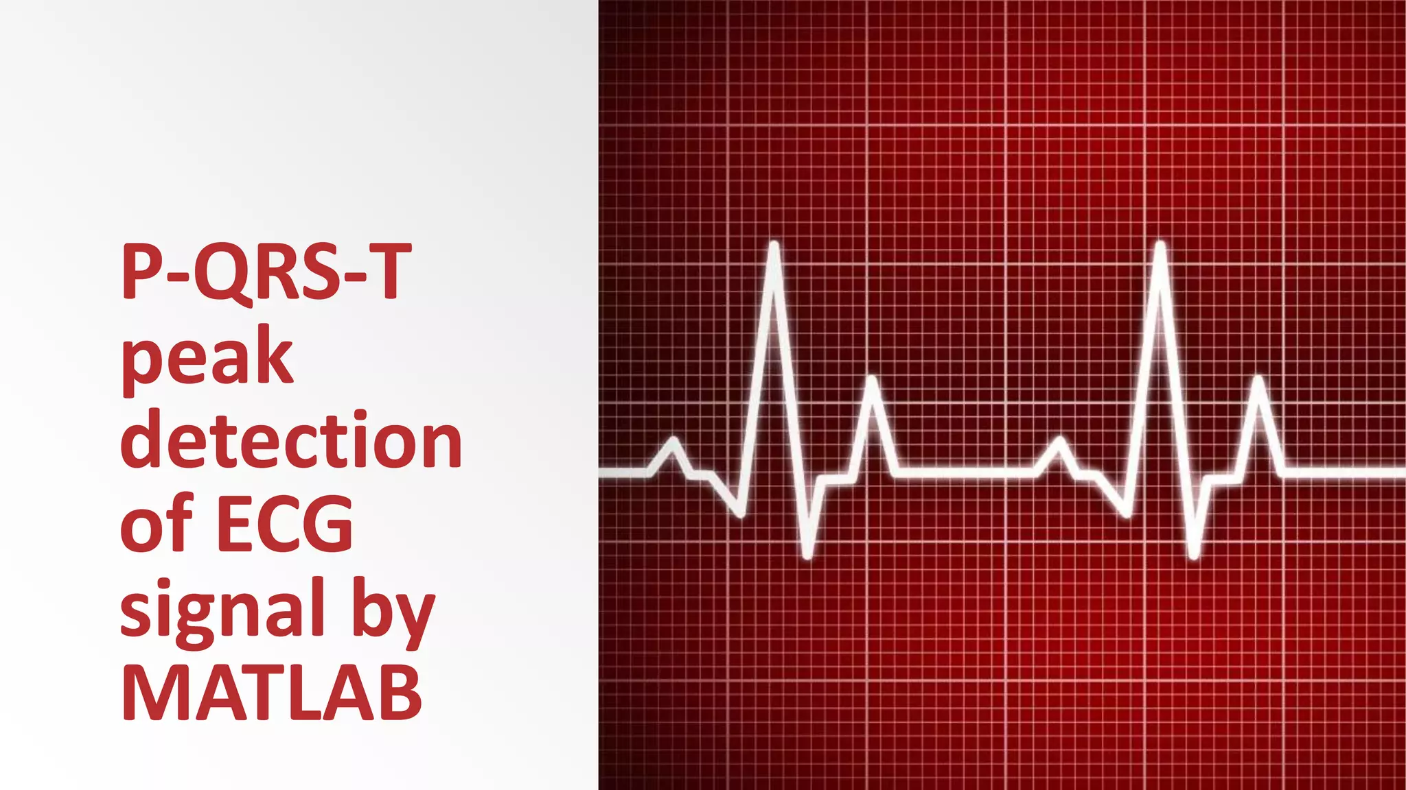 P-QRS-T
peak
detection
of ECG
signal by
MATLAB
 