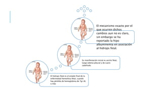 El hidrops fetal es el estado final de la
enfermedad hemolítica fetal, cuando
hay pérdida de hemoglobina de 7gr/dL
o más
Su manifestación inicial es ascitis fetal,
luego edema pleural y de cuero
cabelludo.
El mecanismo exacto por el
que ocurren dichos
cambios aun no es claro,
sin embargo se ha
reportado la hipo
albuminemia en asociación
al hidrops fetal.
 