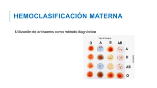 HEMOCLASIFICACIÓN MATERNA
Utilización de antisueros como método diagnóstico
 