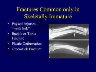Fractures Common only in
Skeletally Immature
• Physeal injuries -
“weak link”
• Buckle or Torus
Fracture
• Plastic Deformation
• Greenstick Fracture
 