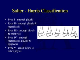 Salter - Harris Classification
• Type I - through physis
• Type II - through physis &
metaphysis
• Type III - through physis
& epiphysis
• Type IV - through
metaphysis, physis &
epiphysis
• Type V - crush injury to
entire physis
 