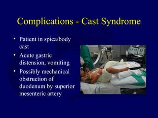 Complications - Cast Syndrome
• Patient in spica/body
cast
• Acute gastric
distension, vomiting
• Possibly mechanical
obstruction of
duodenum by superior
mesenteric artery
 