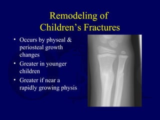 Remodeling of
Children’s Fractures
• Occurs by physeal &
periosteal growth
changes
• Greater in younger
children
• Greater if near a
rapidly growing physis
 