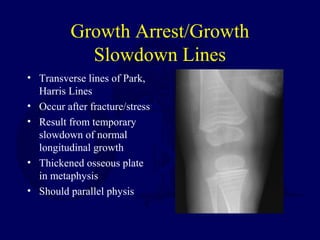 Growth Arrest/Growth
Slowdown Lines
• Transverse lines of Park,
Harris Lines
• Occur after fracture/stress
• Result from temporary
slowdown of normal
longitudinal growth
• Thickened osseous plate
in metaphysis
• Should parallel physis
 