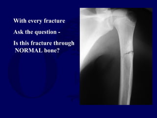 With every fracture
Ask the question -
Is this fracture through
NORMAL bone?
 