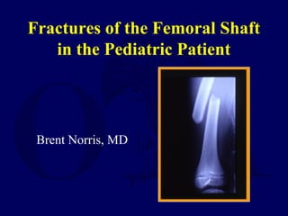 Fractures of the Femoral Shaft
in the Pediatric Patient
Brent Norris, MD
 