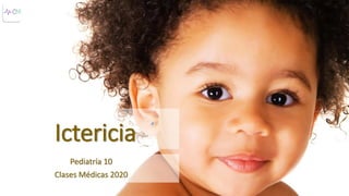 Ictericia
Pediatría 10
Clases Médicas 2020
 