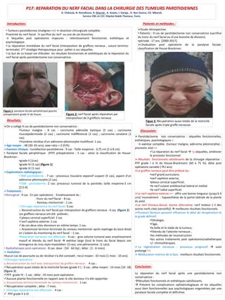 P17: REPARATION DU NERF FACIAL DANS LA CHIRURGIE DES TUMEURS PAROTIDIENNES
D. Chiboub, N. Romdhane, R. Kharrat , A. Azaiez, I. Hariga , O. Ben Gamra, CH. Mbarek.
Service ORL et CCF, Hôpital Habib Thameur, Tunis.
• Tumeurs parotidiennes (malignes ++) → résection chirurgicale complète .
Proximité du nerf facial → sacrifice du nerf ou une de ses branches.
→ Séquelles post opératoires majeures : retentissement fonctionnel, esthétique et
psychologique.
• La réparation immédiate du nerf facial (interposition de greffons nerveux , suture termino-
terminale): 1ère stratégie thérapeutique pour pallier à ces séquelles.
• Le but de ce travail est d’étudier les résultats fonctionnels et esthétiques de la réparation du
nerf facial après parotidectomie non conservatrice.
Patients et méthodes :
Etude rétrospective:
• Patients : 9 cas de parotidectomie non conservatrice (sacrifice
du tronc du nerf facial ou d’une branche de division).
•période : 17 ans [2000-2017].
L’évaluation post opératoire de la paralysie faciale:
classification de House-Brackman.
Introduction:
On a colligé 9 cas de parotidectomie non conservatrice :
•Tumeur maligne : 8 cas : carcinome adénoïde kystique (3 cas) ; carcinome
mucoépidermoide (2 cas) ; carcinome indifférencié (2 cas) ; carcinome canalaire (1
cas).
•Troisième récidive d’un adénome pléomorphe multifocal: 1 cas.
Age moyen : 48 [30- 65 ans]; sexe ratio = 2 (F/H).
Examen clinique : tuméfaction parotidienne : 9 cas : Taille moyenne : 3,75 cm [2 à 8 cm].
• Paralysie faciale périphérique (PFP) préopératoire : 5 cas : selon la classification de House-
Brackman :
•grade II (1cas)
•grade IV (3 cas) (figure 1)
•grade VI (1 cas)
Explorations radiologiques :
• IRM parotidienne : 7 cas : processus tissulaire expansif suspect (5 cas), aspect d’un
adénome pléomorphe (2 cas).
•TDM parotidienne: 2 cas: processus tumoral de la parotide; taille moyenne:3 cm
[2,5-4].
Traitement :
•Chirurgical : 9 cas : En per-opératoire : Envahissement du :
. Tronc du nerf facial : 8 cas.
. Rameau mentonnier : 1 cas.
• Chirurgie réparatrice du nerf facial: 5 cas:
o Reconstruction du nerf facial par interposition de greffons nerveux : 4 cas. (figure 2)
Les greffons nerveux ont été prélevés :
plexus cervical superficiel: 2 cas
nerf saphène externe: 1 cas
de ces deux sites donneurs en même temps: 1 cas.
o Anastomose termino-terminale du rameau mentonnier après repérage du bout distal
en s’aidant du monitoring du nerf facial : 1 cas.
•Réparation nerveuse non effectuée : 4 cas : gros volume tumoral avec envahissement
massif et étendu du nerf facial  exérèse large (tout le tronc du facial depuis son
émergence du trou stylo-mastoïdien (3 cas), une pétrectomie (1 cas)).
• Radiothérapie post-opératoire : 8 cas: dose : [54 - 64 Gy] ; délai : [1 - 6 mois].
 Evolution :
•Aucun cas de poursuite ou de récidive n’a été constaté ; recul moyen : 33 mois [1 mois - 10 ans].
• Chirurgie réparatrice :
o Reconstruction du nerf avec interposition de greffon nerveux : 4 cas :
Récupération quasi-totale de la motricité faciale (grade II ) : 3 cas ; délai moyen : 14 mois [10 -18]
(figure 3).
PFP grade IV : 1 cas ; délai : 10 mois post-opératoire.
Aucune plainte fonctionnelle en rapport avec le site donneur n’a été rapportée.
o Anastomose termino-terminale du rameau mentonnier : 1 cas:
Récupération complète ; délai : 7 mois.
• Chirurgie réparatrice non effectuée : 4 cas :
 PFP grade V à VI .
Résultats:
 Parotidectomie non conservatrice : séquelles fonctionnelles,
esthétiques, psychologiques +
→ exérèse complète (tumeur maligne, adénome pléomorphe) :
pronostic vital ++
La réparation du nerf facial  ↘ séquelles, améliorer
le pronostic fonctionnel
 Résultats fonctionnels satisfaisants de la chirurgie réparatrice :
PFP grade I à III de House-Brackmann (60 à 75 %); délai post
opératoire variable (2 ans).
Le greffon nerveux peut être prélevé du:
•nerf grand auriculaire,
•nerf saphène externe,
•plexus cervical superficiel,
•le nerf cutané antébrachial latéral et médial
•le nerf radial superficiel.
Le nerf saphène externe ++ : offre une bonne longueur (jusqu’à 4
cm)/ inconvénient : hypoesthésie de la partie latérale de la plante
du pied.
Le nerf thoraco-dorsal: bonne alternative: nerf moteur ( # des
autres nerfs cités (sensitifs))  meilleures résultats fonctionnels.
Plusieurs facteurs peuvent influencer le délai de récupération et
le grade définitif:
•l’étiologie,
•l'âge,
•la taille et le stade de la tumeur,
•l’étendu de l'atteinte nerveuse ,
•les méthodes de reconstruction
•les autres traitements post opératoires(radiothérapie
+/- chimiothérapie).
 La régénération nerveuse : processus progressif  suivi
prolongé ++.
 Réeducation motrice de la face : meilleurs résultats fonctionnels
La réparation du nerf facial après une parotidectomie non
conservatrice :
Résultats fonctionnels et esthétiques satisfaisants.
 Prévient les complications ophtalmologiques et les séquelles
aussi bien fonctionnelles que psychologiques engendrées par une
paralysie faciale complète et définitive.
Discussion:
Conclusion:
Figure 1: paralysie faciale périphérique gauche
préopératoire grade IV de House. Figure 2: nerf facial après réparation par
interposition de 3 greffons nerveux
Figue 3: Récupération quasi-totale de la motricité
faciale après triple greffe nerveuse.
 