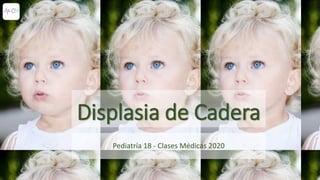 Displasia de Cadera
Pediatría 18 - Clases Médicas 2020
 