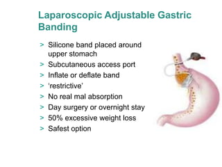 Laparoscopic Adjustable Gastric
Banding
> Silicone band placed around
  upper stomach
> Subcutaneous access port
> Inflate or deflate band
> ‘restrictive’
> No real mal absorption
> Day surgery or overnight stay
> 50% excessive weight loss
> Safest option
 