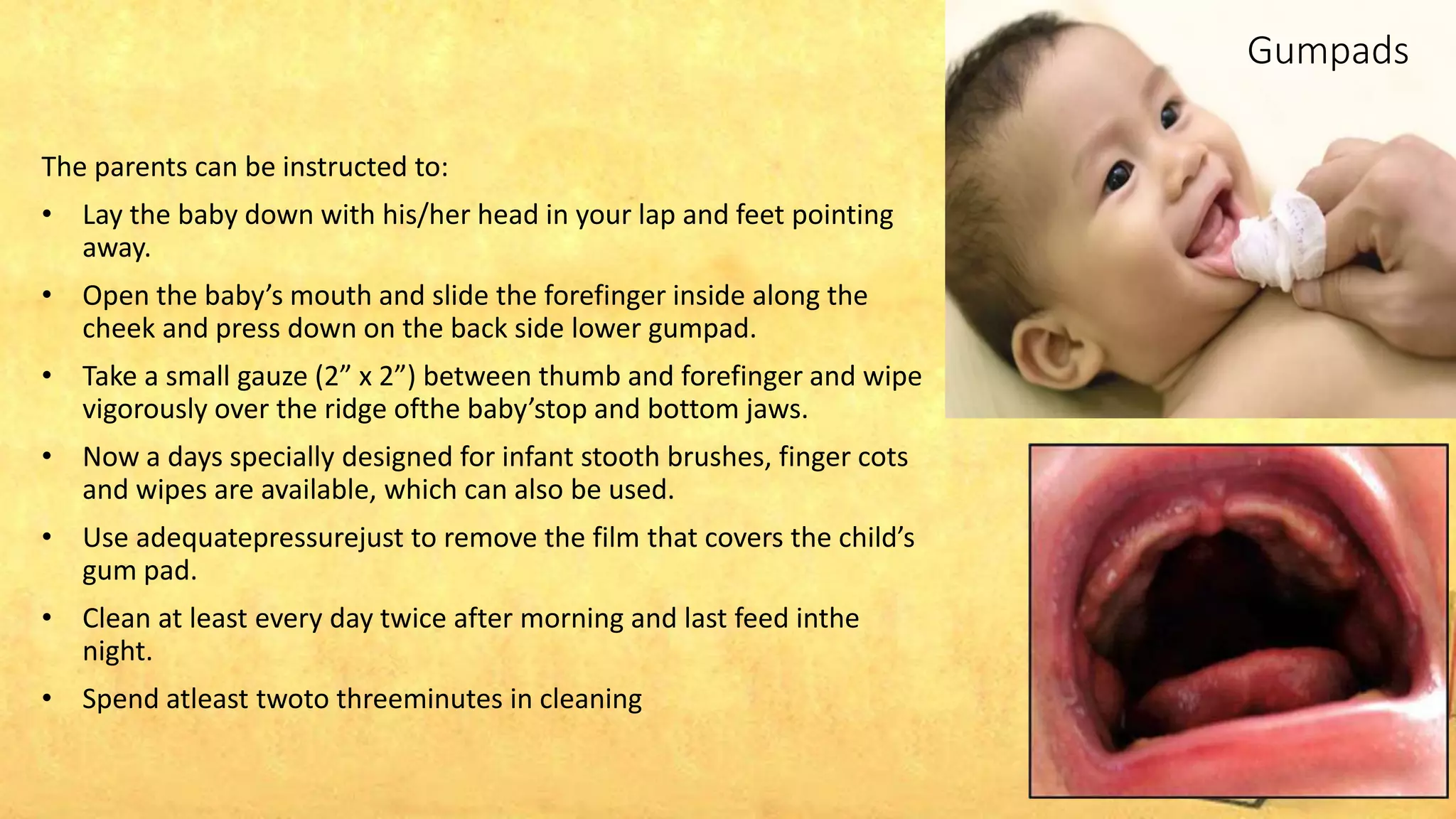 Infant oral health | PPTX