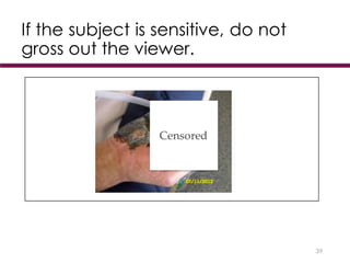 If the subject is sensitive, do not
gross out the viewer.
39
 