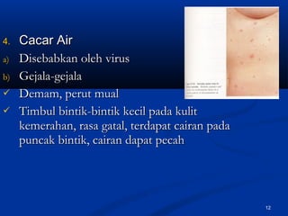 4.4. Cacar AirCacar Air
a)a) Disebabkan oleh virusDisebabkan oleh virus
b)b) Gejala-gejalaGejala-gejala
 Demam, perut mualDemam, perut mual
 Timbul bintik-bintik kecil pada kulitTimbul bintik-bintik kecil pada kulit
kemerahan, rasa gatal, terdapat cairan padakemerahan, rasa gatal, terdapat cairan pada
puncak bintik, cairan dapat pecahpuncak bintik, cairan dapat pecah
12
 