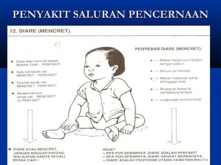 PENYAKIT SALURAN PENCERNAANPENYAKIT SALURAN PENCERNAAN
24
 
