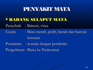 PENYAKIT MATAPENYAKIT MATA
 RADANG SELAPUT MATARADANG SELAPUT MATA
Penyebab : Bakteri, virusPenyebab : Bakteri, virus
Gejala : Mata merah, perih, berair dan banyakGejala : Mata merah, perih, berair dan banyak
kotorankotoran
Penularan : kontak dengan penderitaPenularan : kontak dengan penderita
Pengobatan : Bawa ke PuskesmasPengobatan : Bawa ke Puskesmas
30
 