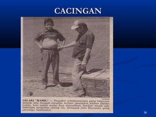 CACINGANCACINGAN
39
 