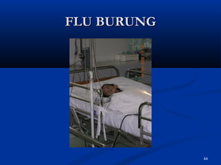 FLU BURUNGFLU BURUNG
44
 