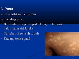 3. Panu3. Panu
a)a) Disebabkan oleh jamurDisebabkan oleh jamur
b)b) Gejala-gejala :Gejala-gejala :
 Bercak-bercak putih pada kulit, bersisikBercak-bercak putih pada kulit, bersisik
halus ,batas tidak jelashalus ,batas tidak jelas
 Tersebar di seluruh tubuhTersebar di seluruh tubuh
 Kadang terasa gatalKadang terasa gatal
9
 