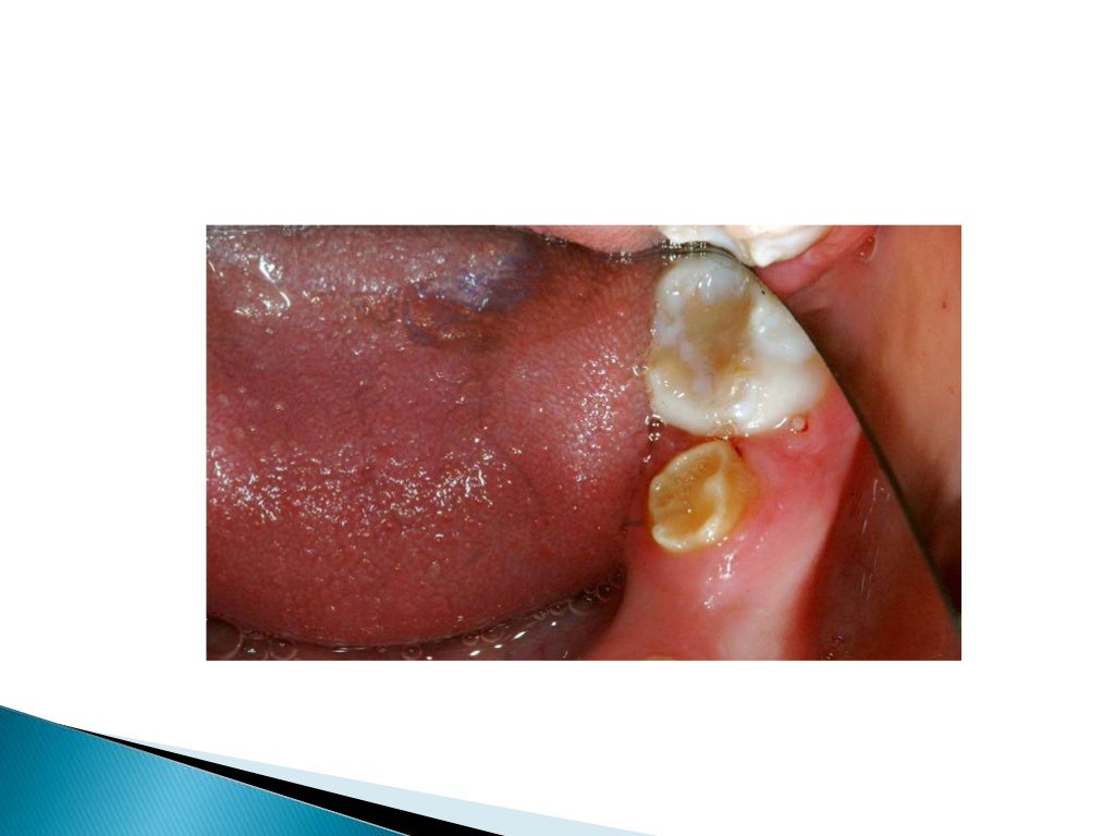 Contemporary Management of Dental Neglect