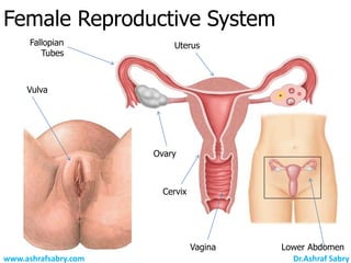 Female Reproductive System
      Fallopian           Uterus
         Tubes



     Vulva




                      Ovary



                        Cervix




                                 Vagina   Lower Abdomen
www.ashrafsabry.com                         Dr.Ashraf Sabry
 