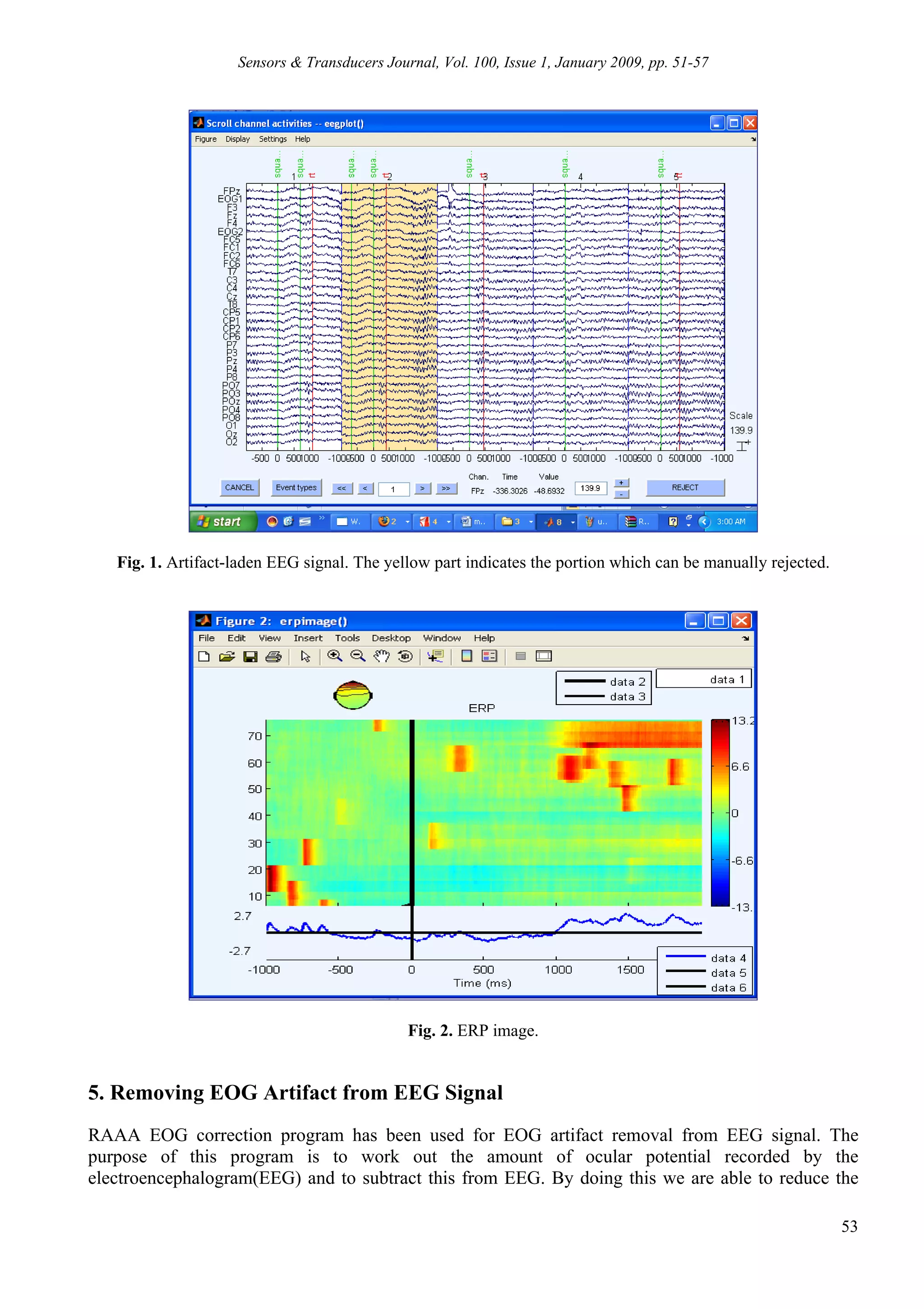 Sensors & Transducers Journal, Vol. 100, Issue 1, January 2009, pp. 51-57




   Fig. 1. Artifact-laden EEG signal. The yellow part indicates the portion which can be manually rejected.




                                              Fig. 2. ERP image.


5. Removing EOG Artifact from EEG Signal
RAAA EOG correction program has been used for EOG artifact removal from EEG signal. The
purpose of this program is to work out the amount of ocular potential recorded by the
electroencephalogram(EEG) and to subtract this from EEG. By doing this we are able to reduce the

                                                                                                              53
 