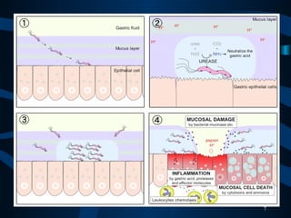 • Mekaqnisme terjadinya
7
 