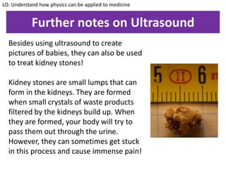 Further notes on Ultrasound
Besides using ultrasound to create
pictures of babies, they can also be used
to treat kidney stones!
Kidney stones are small lumps that can
form in the kidneys. They are formed
when small crystals of waste products
filtered by the kidneys build up. When
they are formed, your body will try to
pass them out through the urine.
However, they can sometimes get stuck
in this process and cause immense pain!
LO: Understand how physics can be applied to medicine
 