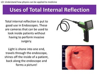 Uses of Total Internal Reflection
Total internal reflection is put to
good use in Endoscopes. These
are cameras that can be used to
look inside patients without
having to perform invasive
surgery.
Light is shone into one end,
travels through the endoscope,
shines off the inside of a patient,
back along the endoscope and
forms a picture!
LO: Understand how physics can be applied to medicine
 