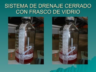 SISTEMA DE DRENAJE CERRADO CON FRASCO DE VIDRIO 