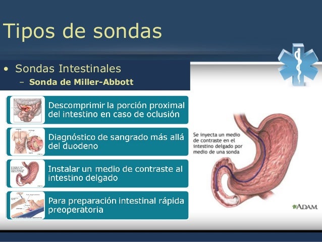 Educación y Técnicas Quirúrgicas - Sonda Nasogástrica