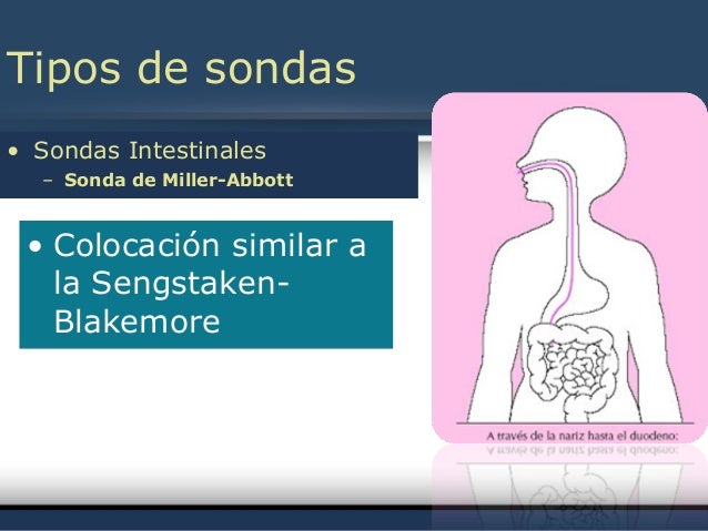 Educación y Técnicas Quirúrgicas - Sonda Nasogástrica