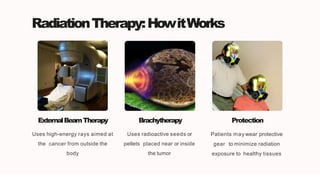RadiationTherapy:HowitWorks
ExternalBeamTherapy
Uses high-energy rays aimed at
the cancer from outside the
body
Brachytherapy
Uses radioactive seeds or
pellets placed near or inside
the tumor
Protection
Patients may wear protective
gear to minimize radiation
exposure to healthy tissues
 
