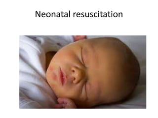 Neonatal resuscitation
 