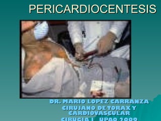 PERICARDIOCENTESIS DR. MARIO LOPEZ CARRANZA CIRUJANO DE TORAX Y CARDIOVASCULAR CIRUGIA I  UPAO 2009 