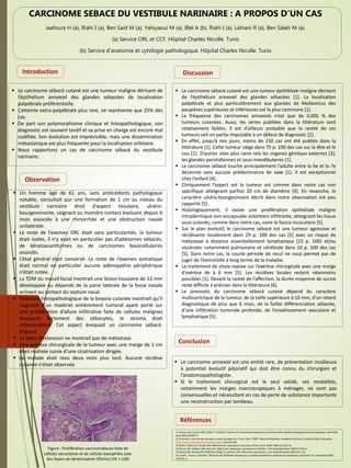 CARCINOME SEBACE DU VESTIBULE NARINAIRE : A PROPOS D’UN CAS
Jaafoura H (a), Riahi I (a), Ben Said M (a), Yahiyaoui M (a), Blel A (b), Riahi I (a), Lahiani R (a), Ben Salah M (a).
(a) Service ORL et CCF. Hôpital Charles Nicolle. Tunis
(b) Service d’anatomie et cytologie pathologique. Hôpital Charles Nicolle. Tunis
Observation
Introduction Discussion
Références
Conclusion
 Le carcinome sébacé cutané est une tumeur maligne dérivant de
l’épithélium annexiel des glandes sébacées de localisation
palpébrale préférentielle.
 L’atteinte extra-palpébrale plus rare, ne représente que 25% des
cas.
 De part son polymorphisme clinique et histopathologique, son
diagnostic est souvent tardif et sa prise en charge est encore mal
codifiée. Son évolution est imprévisible, mais une dissémination
métastatique est plus fréquente pour la localisation orbitaire.
 Nous rapportons un cas de carcinome sébacé du vestibule
narinaire.
 Un homme âgé de 61 ans, sans antécédents pathologique
notable, consultait pur une formation de 1 cm au niveau du
vestibule narinaire droit d’aspect tissulaire, ulcéro-
bourgeonnante, saignant au moindre contact évoluant depuis 6
mois associée à une rhinorrhée et une obstruction nasale
unilatérale.
 Le reste de l’examen ORL était sans particularités, la tumeur
était isolée, il n’y avait en particulier pas d’adénomes sébacés,
de kératoacanthomes ou de carcinomes basocellulaires
associés.
 L’état général était conservé. Le reste de l’examen somatique
était normal en particulier aucune adénopathie périphérique
n’était notée.
 La TDM du massif facial montrait une lésion tissulaire de 12 mm
développée au dépends de la paroi latérale de la fosse nasale
arrivant au contact du septum nasal.
 L’examen histopathologique de la biopsie cutanée montrait qu’il
s’agissait d’un matériel entièrement tumoral ayant porté sur
une prolifération d’allure infiltrative faite de cellules malignes
évoquant fortement des sébocytes, le stroma était
inflammatoire. Cet aspect évoquait un carcinome sébacé.
(Figure)
 Le bilan d’extension ne montrait pas de métastase.
 Une exérèse chirurgicale de la tumeur avec une marge de 1 cm
était réalisée suivie d’une cicatrisation dirigée.
 Le malade était revu deux mois plus tard. Aucune récidive
cutanée n’était observée.  Le carcinome annexiel est une entité rare, de présentation insidieuse
à potentiel évolutif péjoratif qui doit être connu du chirurgien et
l’anatomopathologiste.
 Si le traitement chirurgical est le seul validé, ses modalités,
notamment les marges macroscopiques à ménager, ne sont pas
consensuelles et nécessitant en cas de perte de substance importante
une reconstruction par lambeau.
 Le carcinome sébacé cutané est une tumeur épithéliale maligne dérivant
de l’épithélium annexiel des glandes sébacées [1]. La localisation
palpébrale et plus particulièrement aux glandes de Meibomius des
paupières supérieures et inférieures est la plus commune [1].
 La fréquence des carcinomes annexiels n’est que de 0,005 % des
tumeurs cutanées. Aussi, les séries publiées dans la littérature sont
relativement faibles. Il est d’ailleurs probable que la rareté de ces
tumeurs soit en partie imputable à un défaut de diagnostic [2].
 En effet, jusqu’à nos jours, moins de 150 cas ont été publiés dans la
littérature [1]. Cette tumeur siège dans 75 p. 100 des cas sur la tête et le
cou [1]. D’autres sites plus rares tels les organes génitaux externes [3],
les glandes parotidiennes et sous-mandibulaires [1].
 Le carcinome sébacé touche principalement l’adulte entre la 6e et la 7e
décennie sans aucune prédominance de sexe [1]. Il est exceptionnel
chez l’enfant [4].
 Cliniquement l’aspect est la tumeur est comme dans notre cas non
spécifique atteignant parfois 20 cm de diamètre [4]. En revanche, le
caractère ulcéro-bourgeonnant décrit dans notre observation est peu
rapporté [5].
 Histologiquement, il existe une prolifération épithéliale maligne
intradermique non encapsulée volontiers infiltrante, atteignant les tissus
sous-cutanés, comme dans notre cas, voire le fascia musculaire [5].
 Sur le plan évolutif, le carcinome sébacé est une tumeur agressive et
récidivante localement dans 29 p. 100 des cas [5] avec un risque de
métastase à distance essentiellement lymphatique (15 p. 100) et/ou
viscérales notamment pulmonaire et cérébrale dans 10 p. 100 des cas
[5]. Dans notre cas, la courte période de recul ne nous permet pas de
juger de l’évolutivité à long terme de la maladie.
 Le traitement de choix repose sur l’exérèse chirurgicale avec une marge
d’exérèse de à 6 mm [5]. Les récidives locales restent néanmoins
possibles [1]. Devant la rareté de l’affection, la durée moyenne de survie
reste difficile à préciser dans la littérature [6].
 Le pronostic du carcinome sébacé cutané dépend du caractère
multicentrique de la tumeur, de la taille supérieure à 10 mm, d’un retard
diagnostique de plus que 6 mois, de la faible différenciation sébacée,
d’une infiltration tumorale profonde, de l’envahissement vasculaire et
lymphatique [5].
1/ Duman DG, Ceyhan BB, Celikel T, Ahiskali R, Duman D. Extraorbital sebaceous carcinoma with rapidly developing visceral metastases. Dermatol
Surg 2003;29:987-9.
2/ Cuminet J. Carcinomes annexiel cutané à propos de 17 cas. Paris; 1999. Thèse de Medicine. Académie de Paris, université René Descartes,
http://www.hopitalsaintlouis.org/theses/ cuminet.pdf.
3/ Khan Z, Misra G, Fiander AN, Dallimore NS. Sebaceous carcinoma of the vulva. BJOG 2003;110:227-8.
4/ Omura NE, Collison DW, Perry AE, Myers LM. Sebaceous carcinoma in children. J Am Acad Dermatol 2002;47:950-3.
5/ Nelson BR, Hamlet KR, Gillard M, Railan D, Johnson TM. Sebaceous carcinoma. J Am Acad Dermatol 1995;33:1-15.
6/ Conill C, Toscas I, Morilla I, Mascaro JM. Radiation therapy as a curative treatment in extraocular sebaceous carcinoma. Br J Dermatol 2003;
149:441-2.
Figure : Prolifération carcinomateuse faite de
cellules vacuolaires et de cellules basophiles avec
des foyers de kératinisation (flèche) (HE x 100)
 