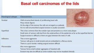 Uveal melanomas
Malignant tumor of melanocytes in the iris, C.B and choroid.
Choroidal tumours make up 80% of these.
Tumou...
