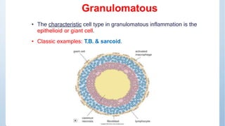 Macrophage & granulomatous
inflammation
 