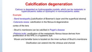 Glycogen infiltration
Glycogen infiltration into tissue → structural change
Examples:
• Diabetes mellitus: lacy vacuolatio...