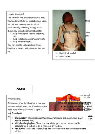 135
What can be done to prevent acne?
• Wash your skin twice a day and
after exercise. Use a soft soap.
• Shampoo your hair daily.
• Don’t touch the spots.It causes
bleeding into the skin , infection
and more spots.
How is it treated?
This can be a very difficult condition to treat.
Your doctor will help you to start eating again.
You will also probably need individual
psychotherapy and family therapy. Your
doctor may prescribe some medicine to:
• help reduce your fear of becoming
fat
• help reduce depression and anxiety
• help you gain weight.
You may need to be hospitalised if your
condition is severe and dangerous four your
life.
What can be done to prevent anorexia
nervosa and maintain good
physical health?
Accepting yourself and your body can help
prevent this problem. In addition you can:
• See your doctor.
• Eat all your meals.
• Don’t use laxatives.
• Don’t over exercise.
• Don’t drink alcohol.
• Don’t smoke.
Acne
What is acne?
Acne occurs when the oil glands in your skin
become blocked. More than 90% of teenagers
have acne. Acne you causes 3 types of
spots: blackheads, whiteheads (pimples), and
red bumps on your face, neck, and shoulders.
Symptoms:
• Blackheads:A blackhead results when dead skin cells and sebum block a hair
follicle near the skin.
• Whiteheads (pimples): These are tiny, white spots and are caused by the
accumulation of sebum or oil in the pores of the skin.
• Red bumps: These are the result of the infection which has spread beyond the
oil gland.
 