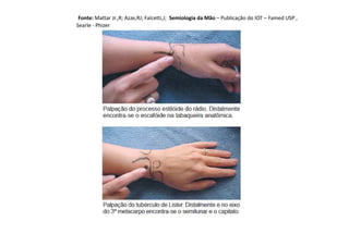 Fonte: Mattar Jr.,R; Azze,RJ; Falcetti,J; Semiologia da Mão – Publicação do IOT – Famed USP ,
Searle - Phizer
 