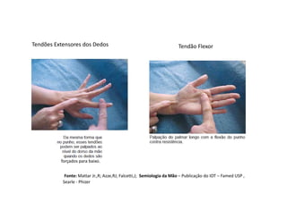forçados para baixo.
Tendões Extensores dos Dedos Tendão Flexor
Fonte: Mattar Jr.,R; Azze,RJ; Falcetti,J; Semiologia da Mão – Publicação do IOT – Famed USP ,
Searle - Phizer
 