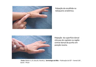 Palpação da superfície dorsal
côncava do capitato na região
central dorsal do punho em
posição neutra.
Palpação do escafóide na
tabaqueira anatômica.
Fonte: Mattar Jr.,R; Azze,RJ; Falcetti,J; Semiologia da Mão – Publicação do IOT – Famed USP ,
Searle - Phizer
 