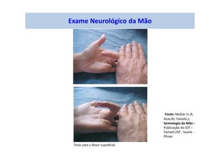 Exame Neurológico da Mão
Fonte: Mattar Jr.,R;
Azze,RJ; Falcetti,J;
Semiologia da Mão –
Publicação do IOT –
Famed USP , Searle -
Phizer
 