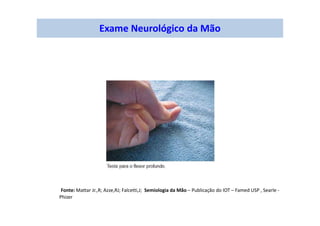 Exame Neurológico da Mão
Fonte: Mattar Jr.,R; Azze,RJ; Falcetti,J; Semiologia da Mão – Publicação do IOT – Famed USP , Searle -
Phizer
 